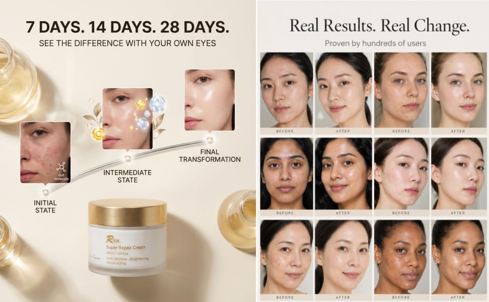Amazon.com: R828 Super Repair Moisturizing Skin Recovery Anti